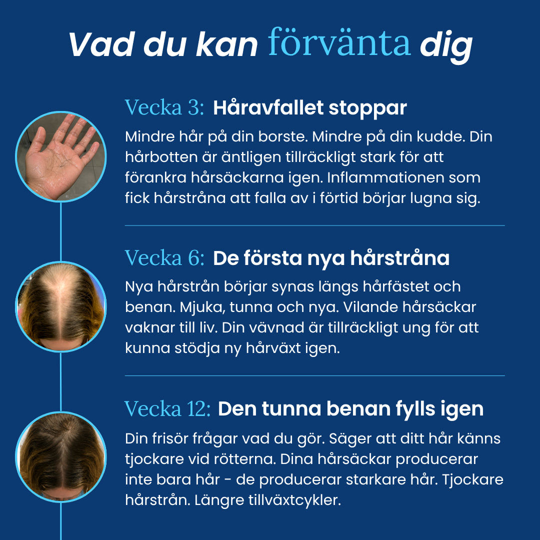 Forva Återväxt-Serum - Kvinnor