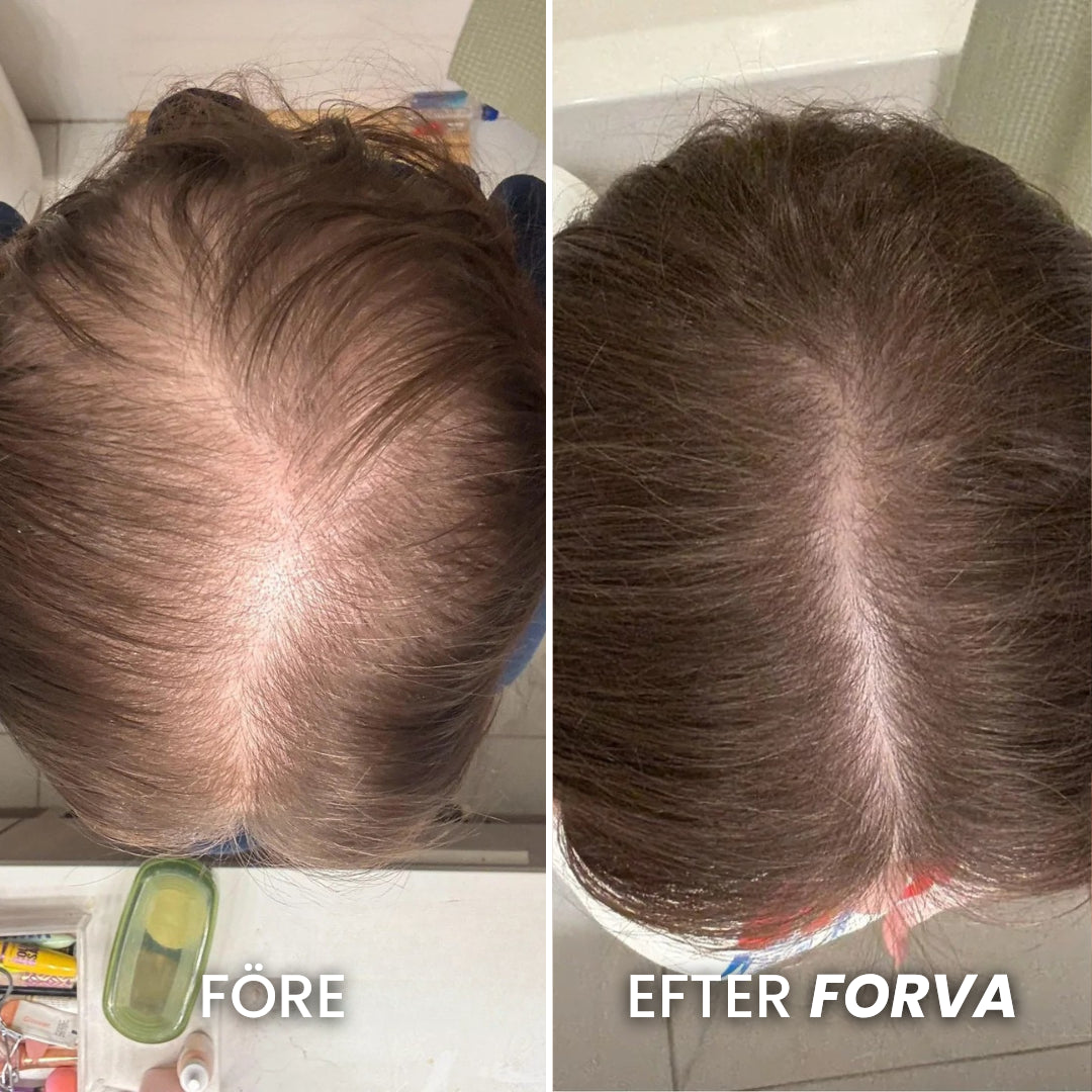 Forva Återväxt-Serum - Kvinnor