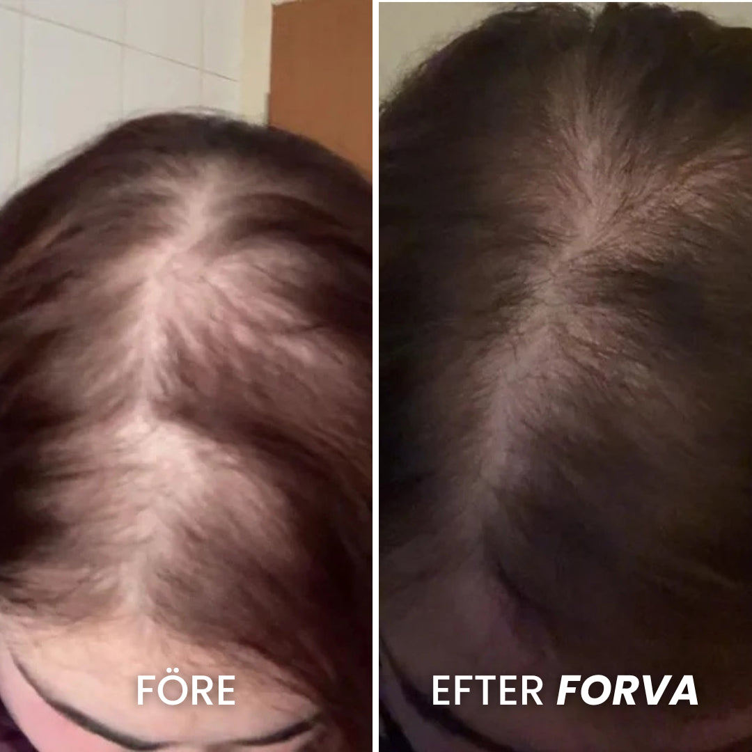 Forva Återväxt-Serum - Kvinnor