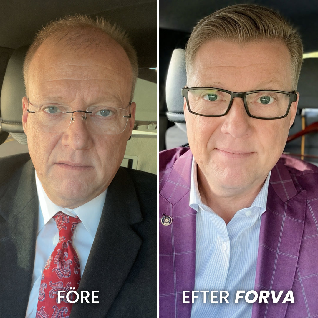 Forva Återväxt-Serum