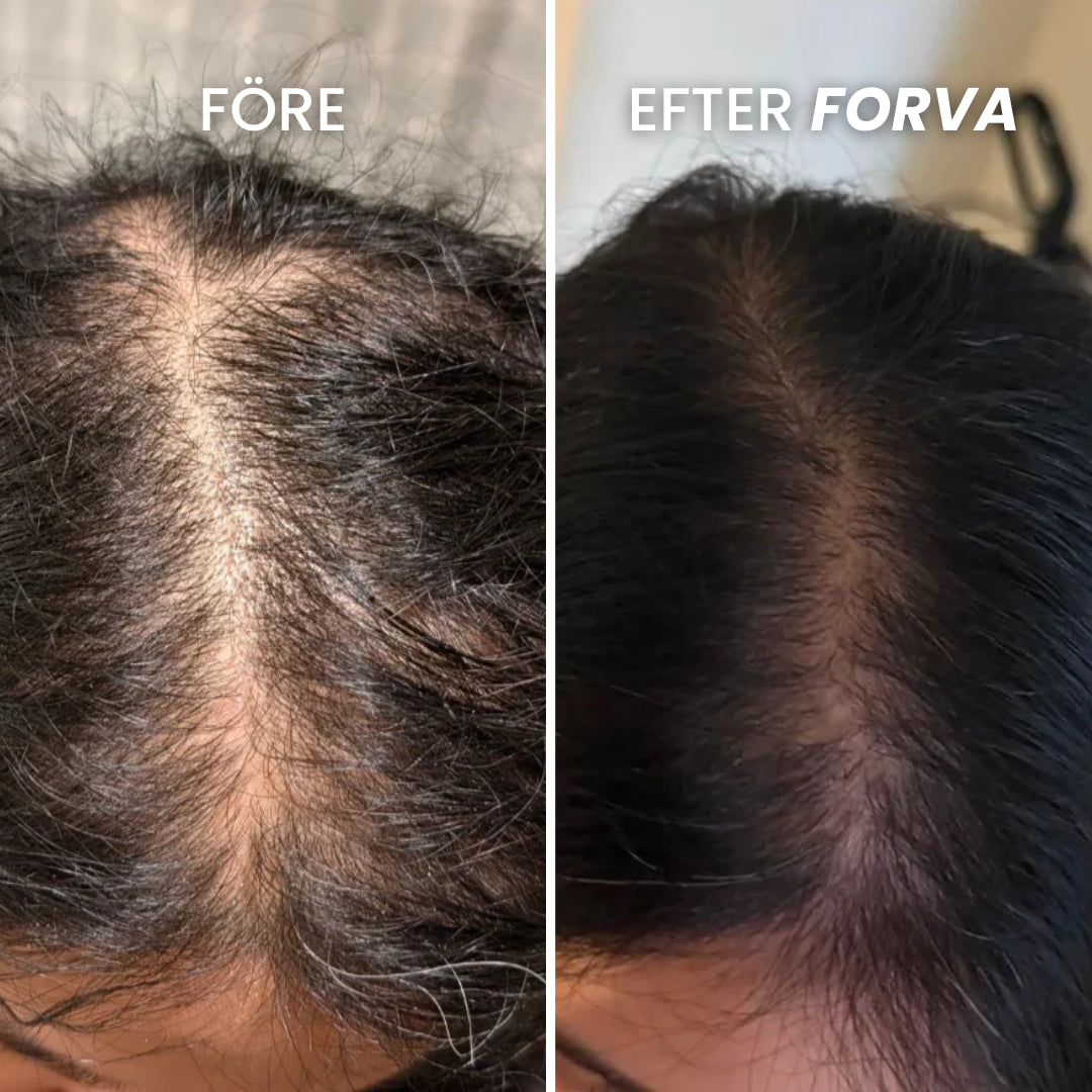Forva Återväxt-Serum - Kvinnor