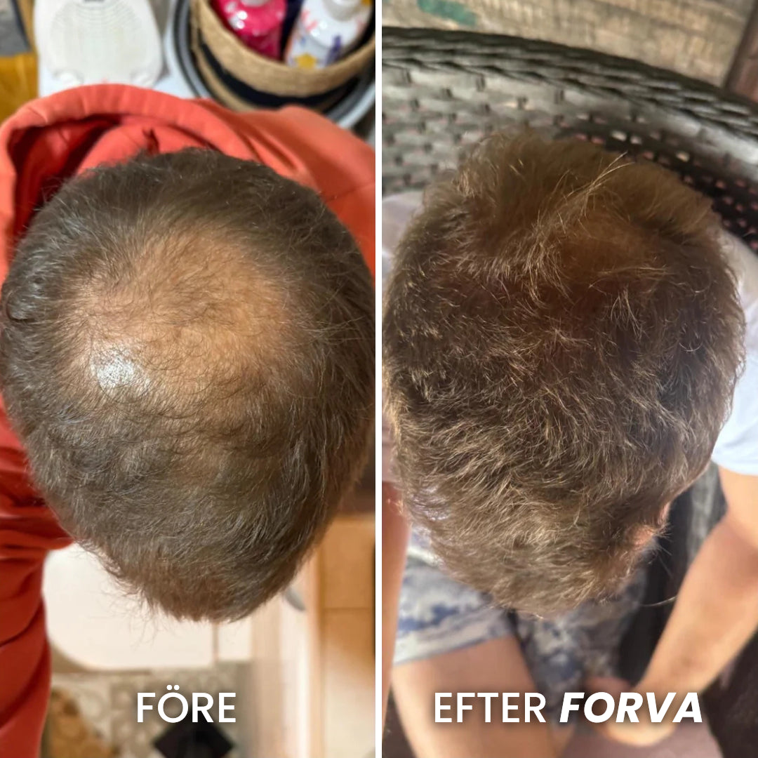 Forva Återväxt-Serum