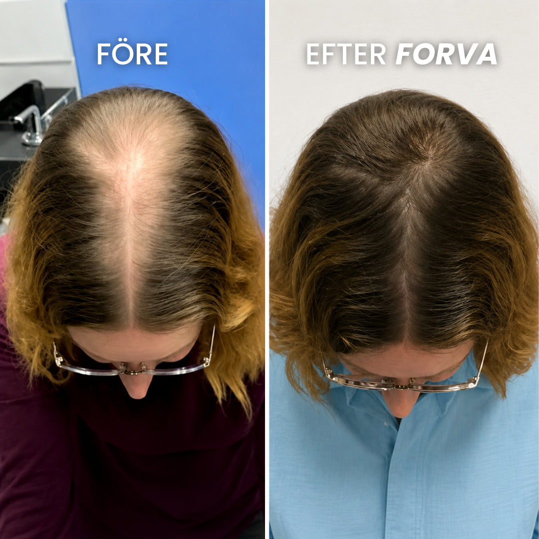 Forva Återväxt-Serum - Kvinnor