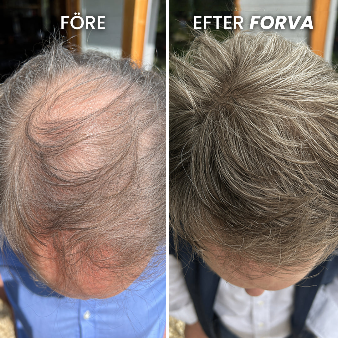 Forva Återväxt-Serum
