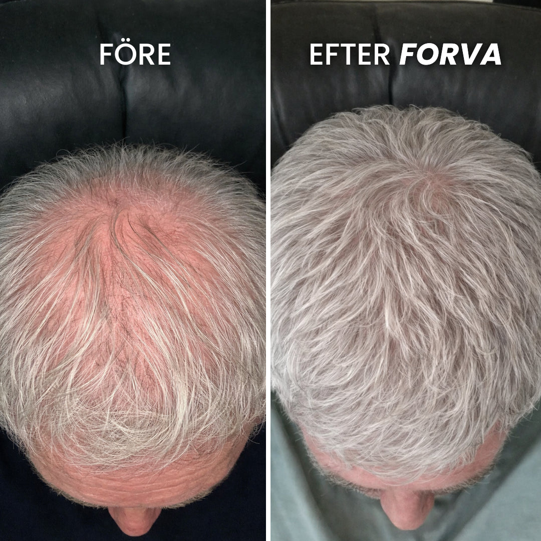 Forva Återväxt-Serum