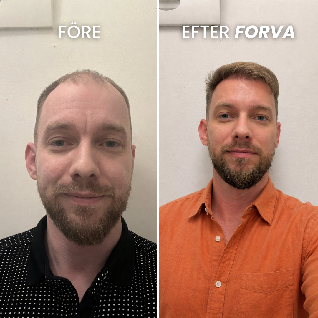 Forva Återväxt-Serum
