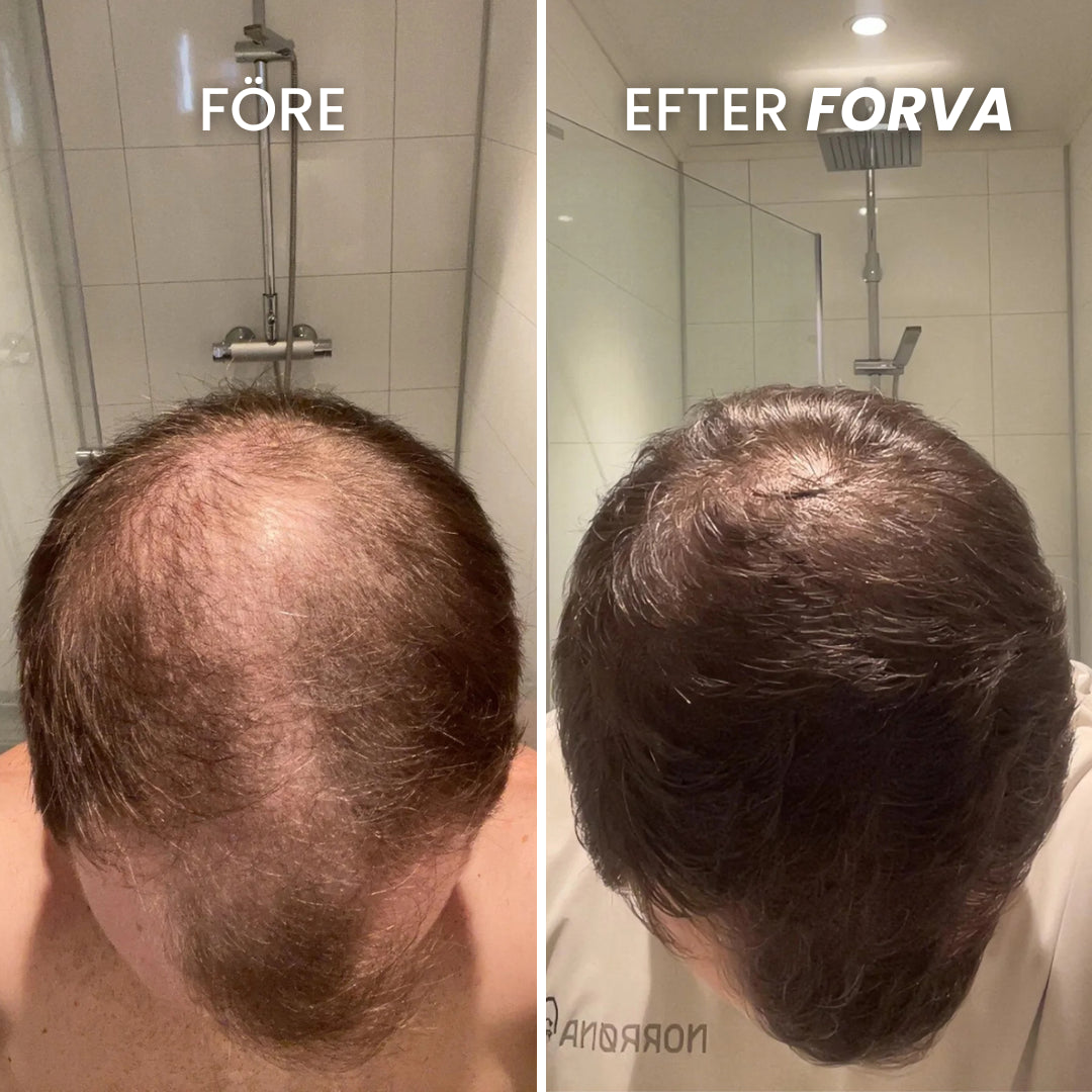 Forva Återväxt-Serum