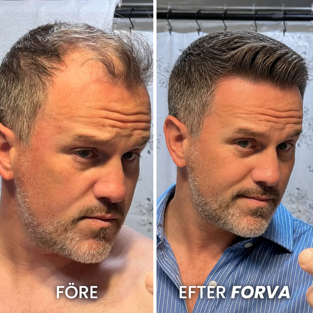 Forva Återväxt-Serum